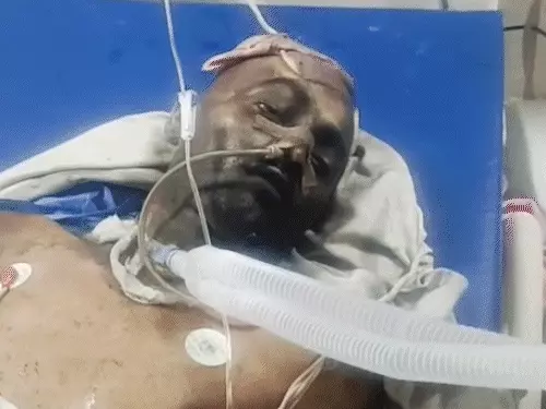 SMS hospital fire: ट्रॉमा सेंटर में आग का कहर, 3 महिलाएं सहित 8 मरीजों की मौत